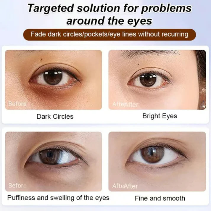 🔥Anti-wrinkle eye serum oil🔥 (Buy 1 Get 1 Free 🔥🔥)