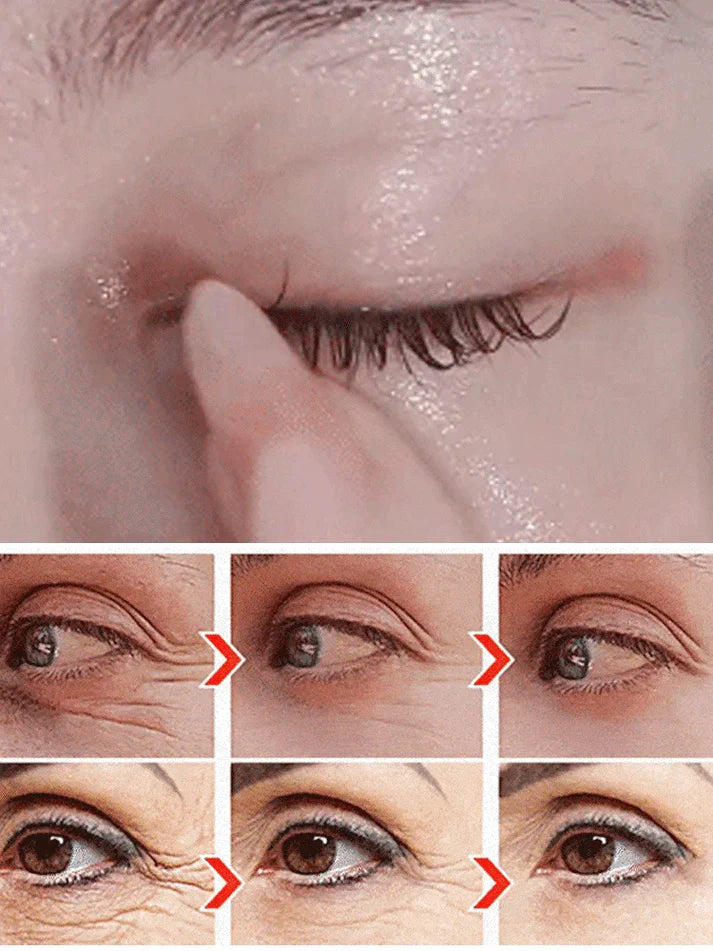 🔥Anti-wrinkle eye serum oil🔥 (Buy 1 Get 1 Free 🔥🔥)