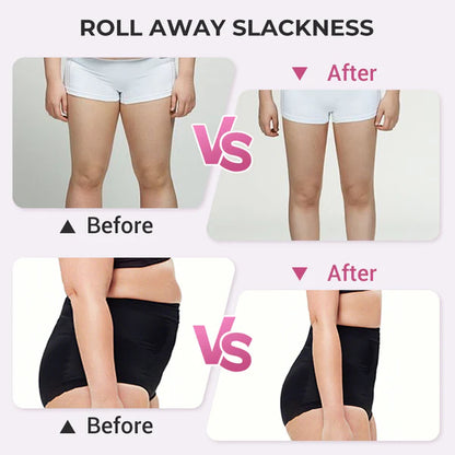 🔥 Leg Massager Roller - Ultimate Muscle Relief| Buy 1 Get 1 Free💆‍♀️✨