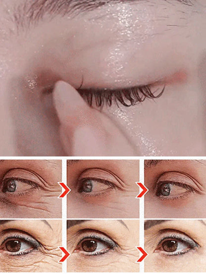 🔥Anti-wrinkle eye serum oil🔥 (Buy 1 Get 1 Free 🔥🔥)